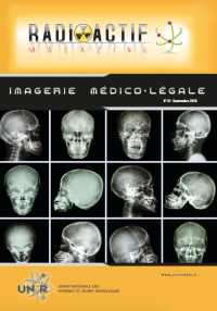 UNIR - Radioactif