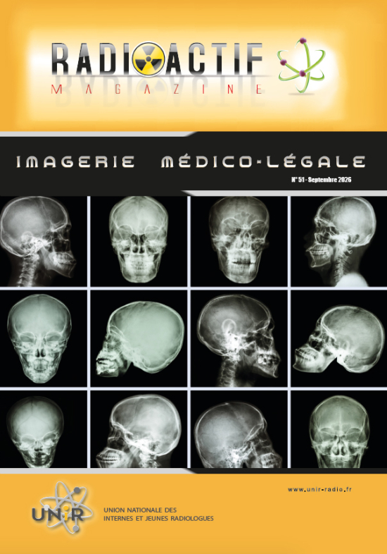 UNIR - Radioactif