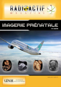 Imagerie Prénatale