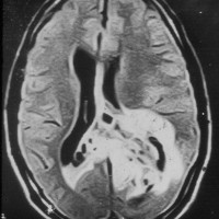 logo Neuropathologie - RÉSEAU SOCIAL PUBLIC