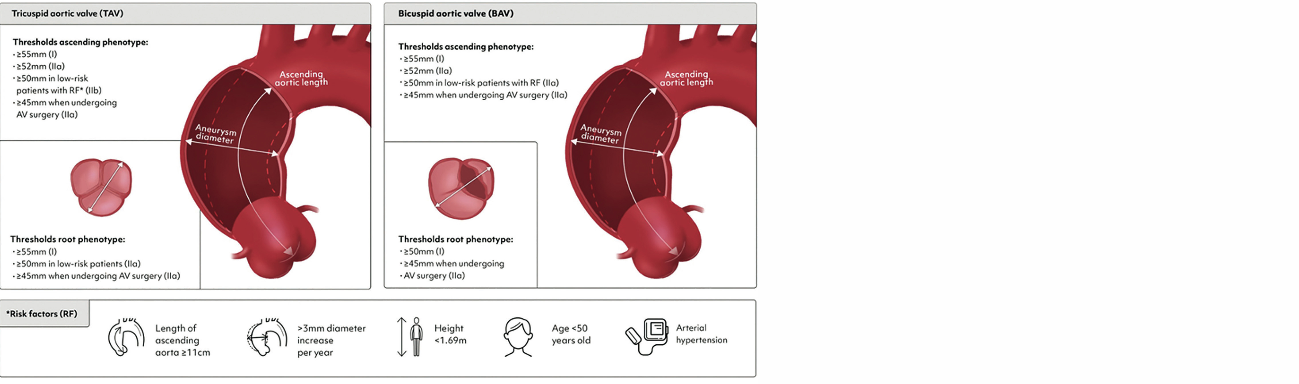 Recommandations 2025 sur la chirurgie de l’aorte
