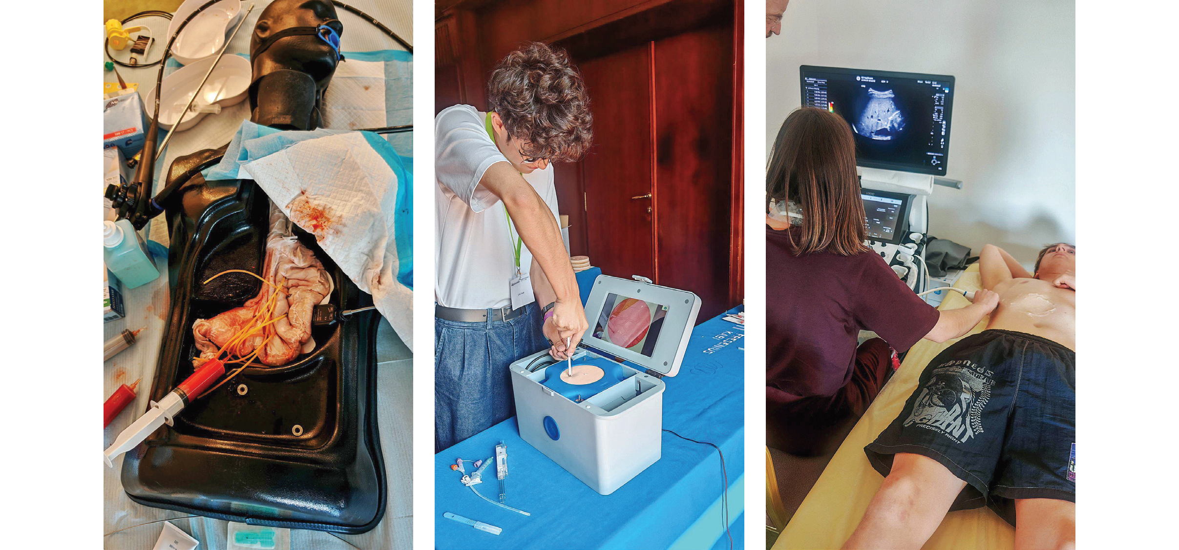 Ton événement international incontournable de l’internat d’HGE : UEG Summer School – Prague