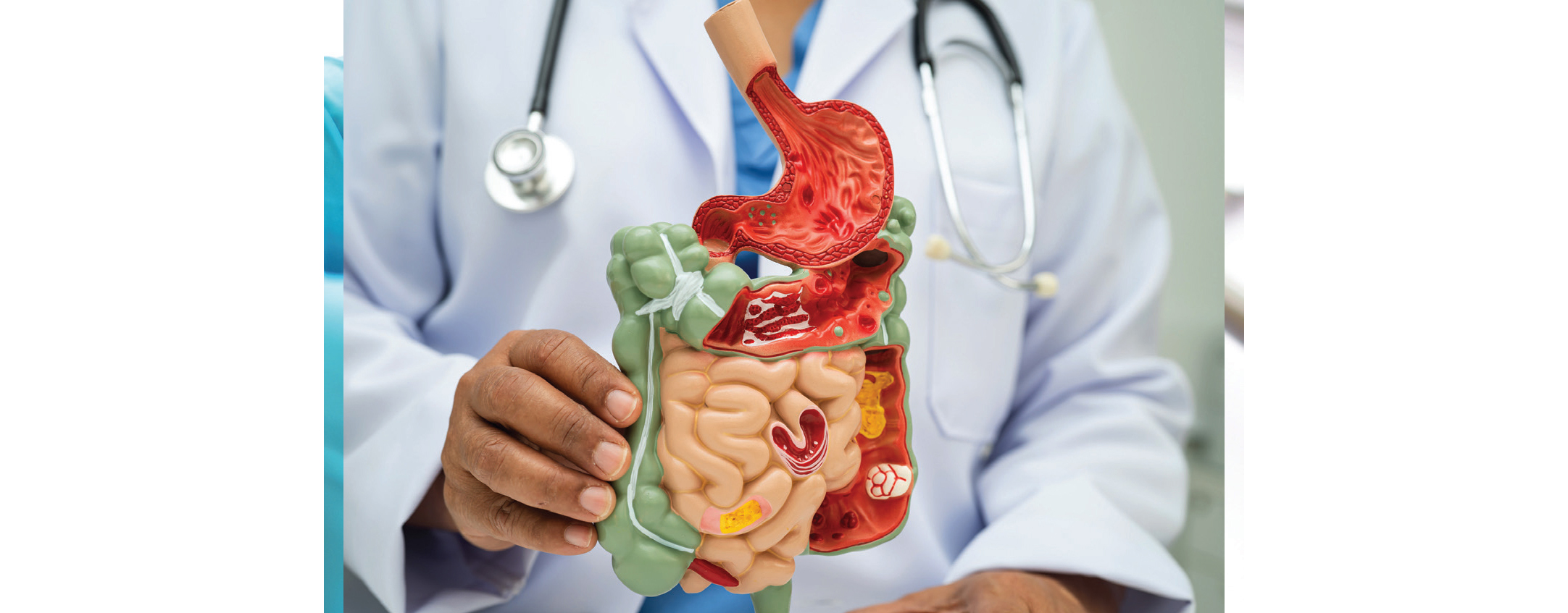 Chirurgie et traitement des GIST