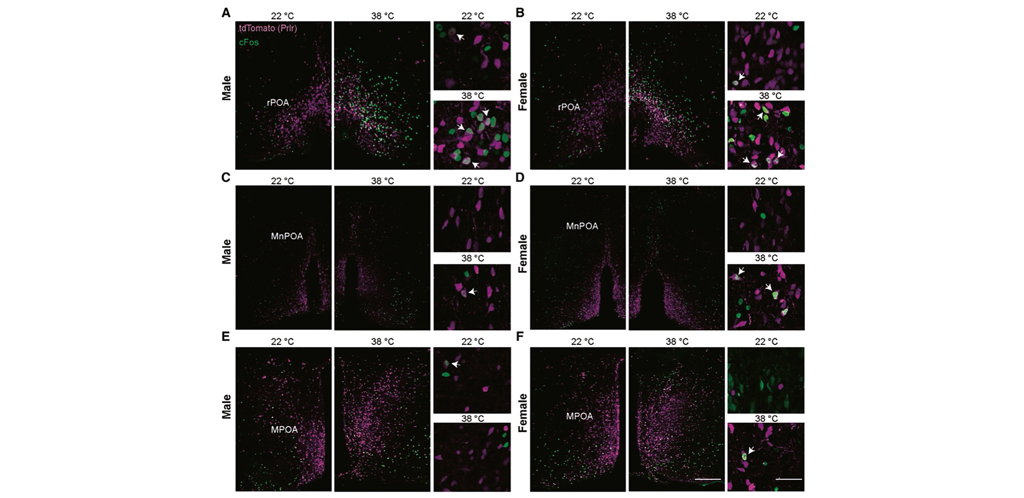 Endocrinologie - La modulation des circuits thermorégulateurs par la prolactine permet une adaptation face aux défis thermiques de la grossesse