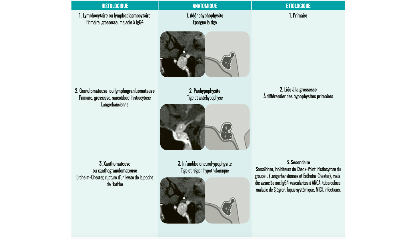 Atelier : Hypophysite de l’enfant et de l'adulte