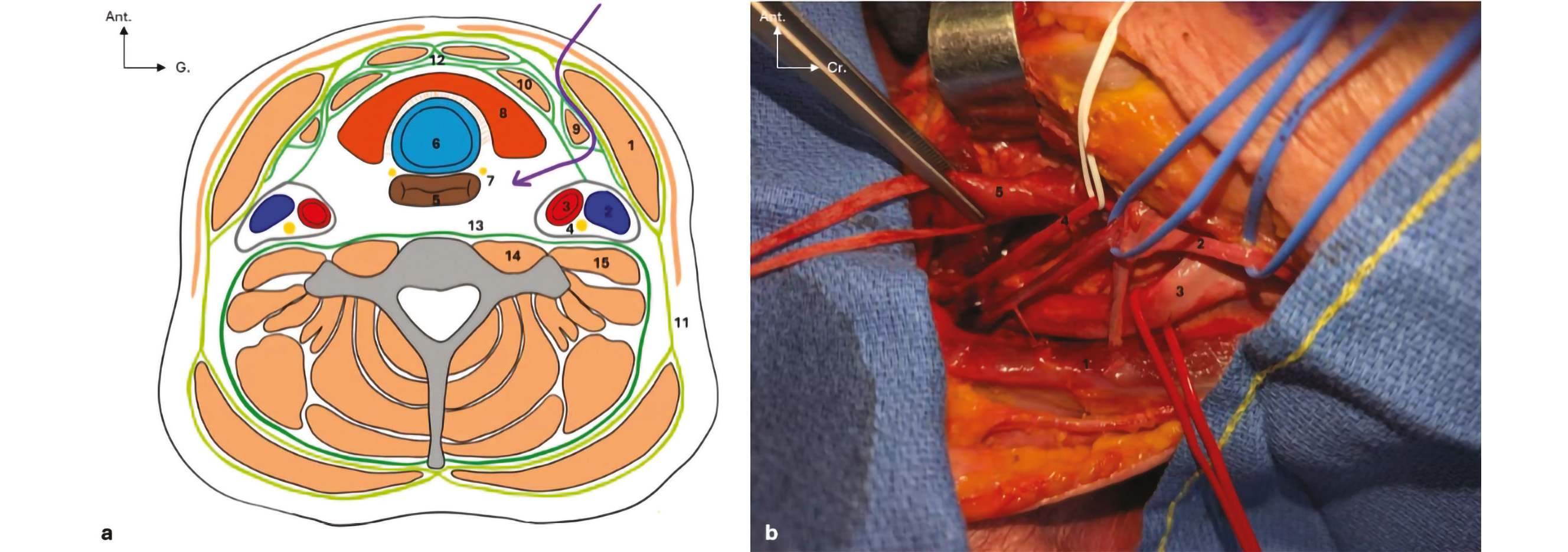 Bases anatomiques de la chirurgie oesogastrique