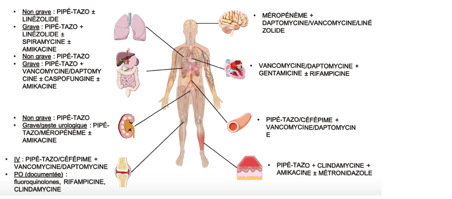 Les antibiotiques, c’est pas automatique