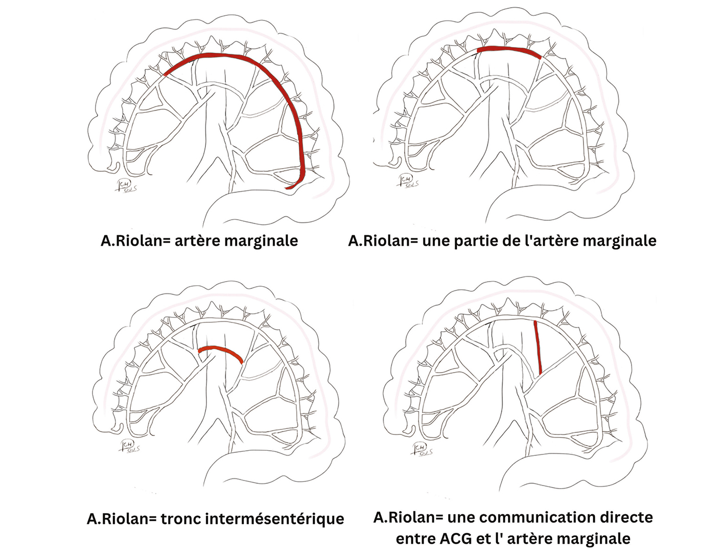 L'arcade de Riolan et les communications intermésentériques