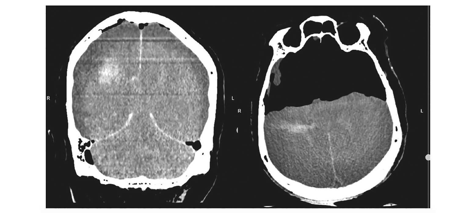 Recommandations pour l’interprétation du scanner post mortem (PMCT)